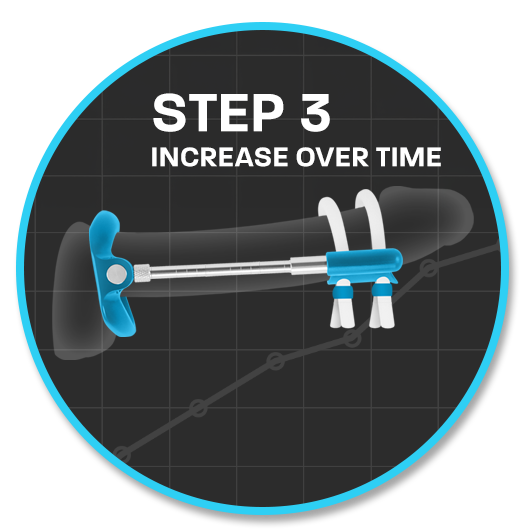 Maximum change typically reported